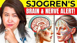 Can Sjogren's Affect Your Brain? What Every Patient Needs to Know!