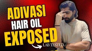 Adivasi Hair Oil Scam EXPOSED: Shocking Lab Results & Fake Reviews Debunked | Mridul Madhok