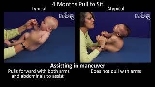 4 Month Old Baby Typical & Atypical Development Side by Side