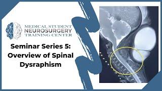 Seminar Series 5: Overview of Spinal Dysraphism