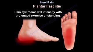 Heel Pain, causes and treatment, plantar fasciitis