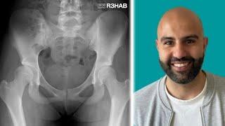 167. Hip Dysplasia w/ Mehmet Gem