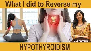 What I did to Reverse my HYPOTHYROIDISM ?  | Dr.sharmika's Open talk |#drsharmika #vp #thyroid