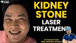 Kidney stone laser treatment |  Fast, Effective, and Painless Solution #kidneystone #RIRS