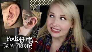 How I Healed My DAITH Piercing + PICTURES!