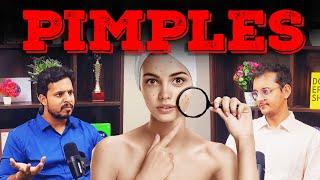 Cure and reason for pimples. | RUPEES WITH ROHIT | @panchayatwithrohit