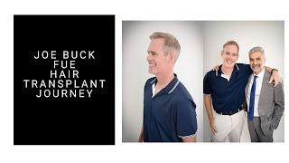 Joe Buck - FUE Hair Transplant Journey