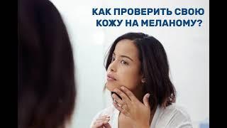 Как проверить кожу на меланому?