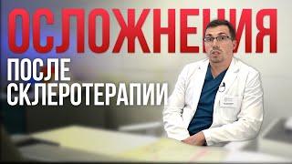 ОСЛОЖНЕНИЯ после СКЛЕРОТЕРАПИИ? Что делать?