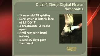 VersaTron Shock Wave- Dr  Kent Allen Chronic Deep Digital Flexor Tendonitis