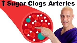 Prevent High Blood Sugar from Causing Clogged Arteries | Dr. Mandell