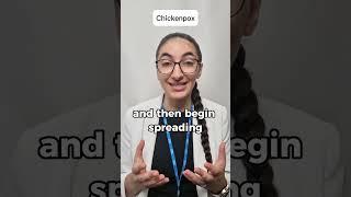 Chickenpox symptoms | @pharmacistv NHS #shorts