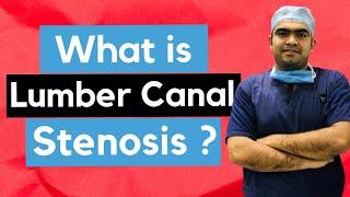 What is Lumber Canal Stenosis / Spinal Stenosis ?