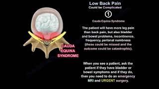 Understanding Complicated Low Back Pain: Causes, Symptoms, and Treatment Options