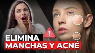 Niacinamida: El Secreto para una piel sin acné, manchas y envejecimiento