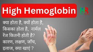 High hemoglobin, High hemoglobin causes, high hemoglobin symptoms and treatment,