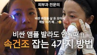 eng)아직도 속건조에 ‘비싼 화장품'만 사고 있다면… |속건조 해결 피부과 시술 총정리 | 피부과 전문의