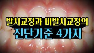 발치교정과 비발치교정의 진단기준 4가지!