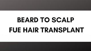 Beard to Scalp FUE Hair Transplant Q + A with Dr. Mohebi