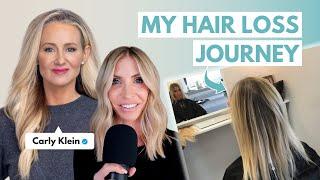 Ep. 49 My Emotional Hair Loss Journey: From Diagnosis & Treatments to Hope & Healing | Carly Klein