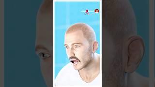 قام بتحويل ساقه المبتور الى … ؟ 