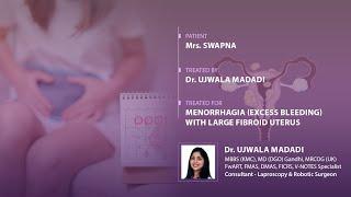 Successful Menorrhagia Treatment for Large Fibroid Uterus | Dr. Ujwala Madadi | Virinchi Hospitals