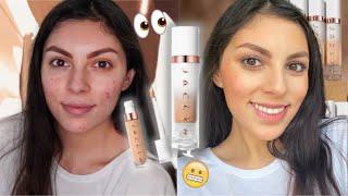 Another Stage 5 Clinger!? Jaclyn Cosmetics Blurring Skin Tint & Faux Filter Concealer Review on ACNE