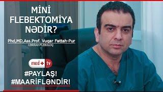 Miniflebektomiya nedir - Dr. Vuqar Fettah-Pur Fleboloq Cerrah / MedplusTV