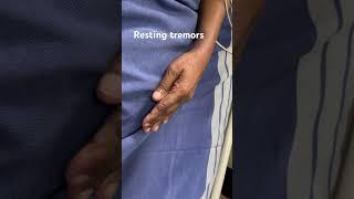 Resting tremors for medical students #restingtremors