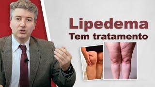 Tratamento de Lipedema. Tem tratamento.