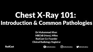 RadCast Academy: Introduction To The Chest X-Ray & Common Pathologies #cxr #radcast