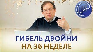 Гибель двойни. Причины и как предупредить повторение. Отвечает доктор Гузов.