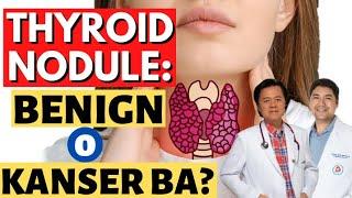 Thyroid Nodule: Benign o Kanser Ba?- By Doc Gim Dimaguila (ENT Doctor) and Doc Willie Ong