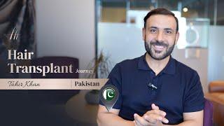 Tahir Khan's Hair Transplantation Journey