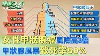 女性甲狀腺癌風險高3倍 甲狀腺風暴致死率50% 健康2.0