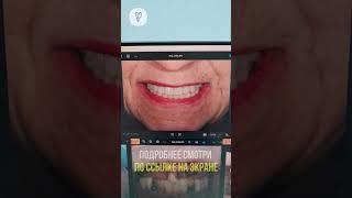 От драматичного начала к отличному результату. Имплантация зубов.