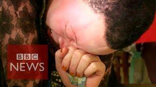 Albinos in Tanzania: 'killed like animals'