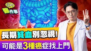 頭暈 疲倦 貧血 竟是 惡性腫瘤 引起？！ 小心3種癌症找上門【江P醫件事#94】江坤俊醫師