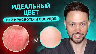 Как избавиться от покраснений и сосудов на лице? Лучшие советы и процедуры от дерматолога