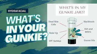 Whats In Your Gunkie ? - Hydrafacial UK