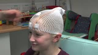 Having an EEG test at Bristol Royal Hospital for Children