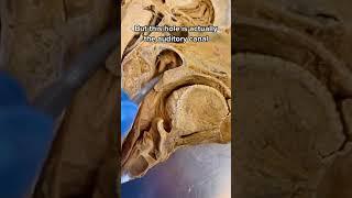 Anatomy of the ear, nose and throat