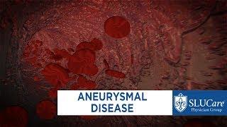 Treating Aneurysmal Disease - SLUCare Vascular Surgery