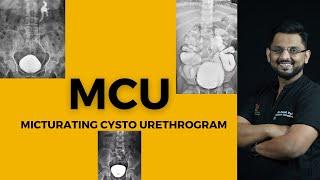 MCU | Micturating Cysto- Urethrogram | UTI | Dr.Kunal Pai | Paediatric Nephrologist