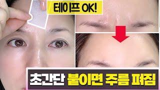 Face wrinkle removal tape  anti-wrinkle tape! an anti-wrinkle tape