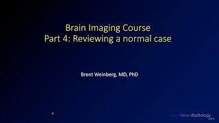 Brain imaging course – 4 – Reviewing a normal case