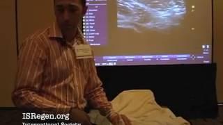 Ultrasound Guided Lateral Femoral Cutaneous Nerve Injection Technique