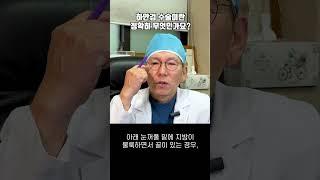 하안검 수술이란 정확히 무엇인가요?