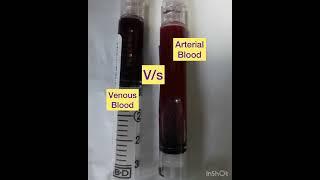 Arterial blood v/s Venous blood