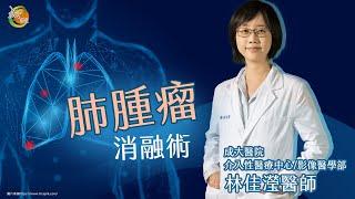 【成大醫院】成大e學堂 《肺腫瘤消融術》 影像醫學部林佳瀅醫師